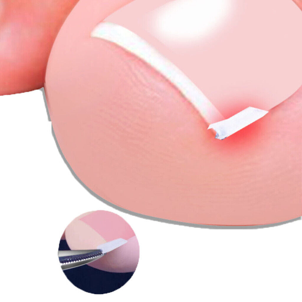 Ingrown Toenail Correction Tools Toe  Cleaner Tool 50 Liner
