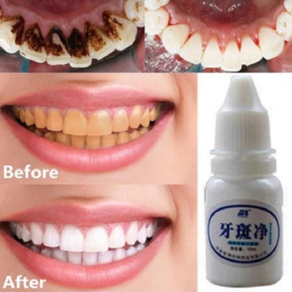 10ml Teeth Whitening Water Oral Hygiene Cleaning Teeth Care Tooth Cleaning