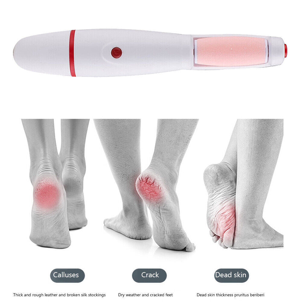 Electric Pedicure Foot Callus Grinder USB Feet Care Dead Skin Remover (Red)