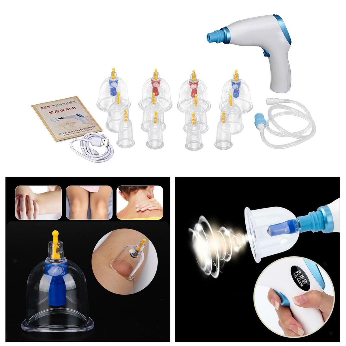 Wet/Dry Electric Cupping Kit Cupping   for Back Massage  Healthy