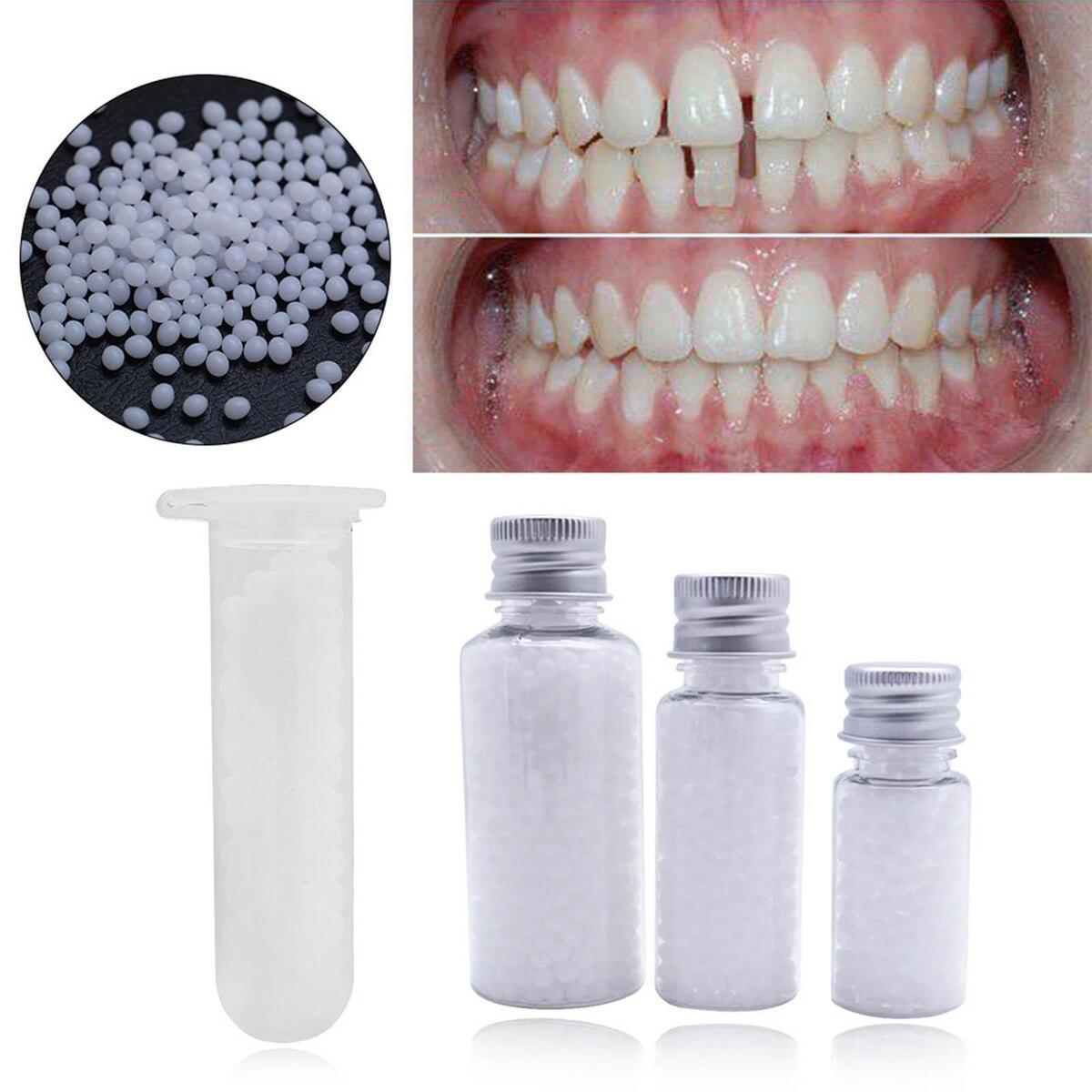 50G Temporary  Repair Kit False  Moldable  Veneers White
