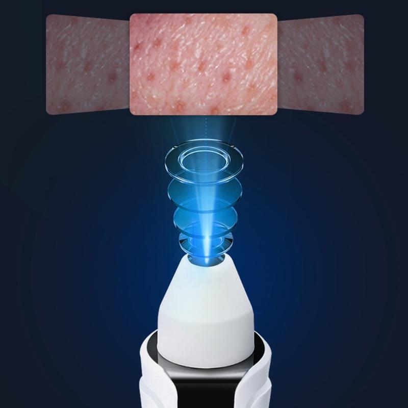 Electric Pore Cleaner Smart Camera Visible Blackhead Remover Comedones Extractor