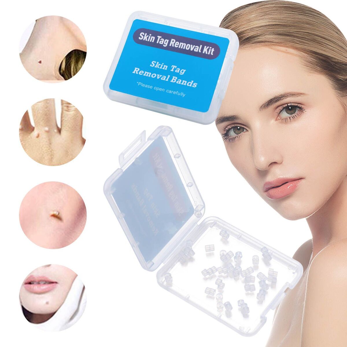 Care Tools Face Care Mole Wart Removal Rubber Bands Micro Band Skin Tag Removal