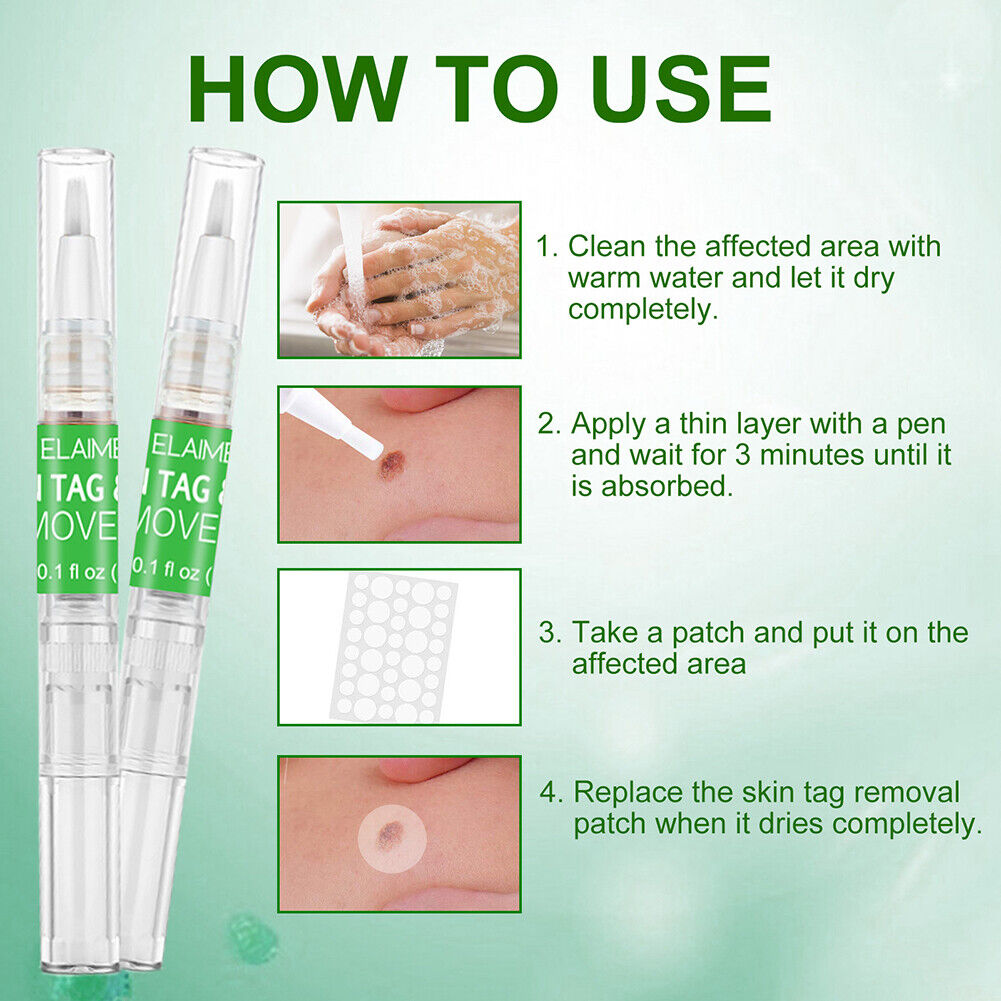 Portable Skin Tag Remover Pen Patch Wart Remove Acne Mole Treatment Tool