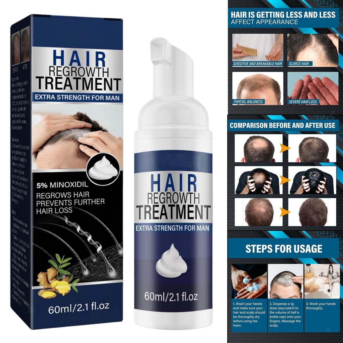 Hair Growth Essence Spray Anti Hair Loss Fast Grow for Prevent Hair Loss