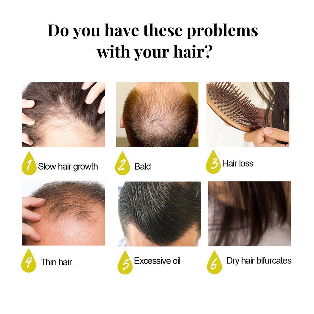 Fast Hair Growth Floral Scent Hair Wash Rice Soap Rice Shampoo Soap