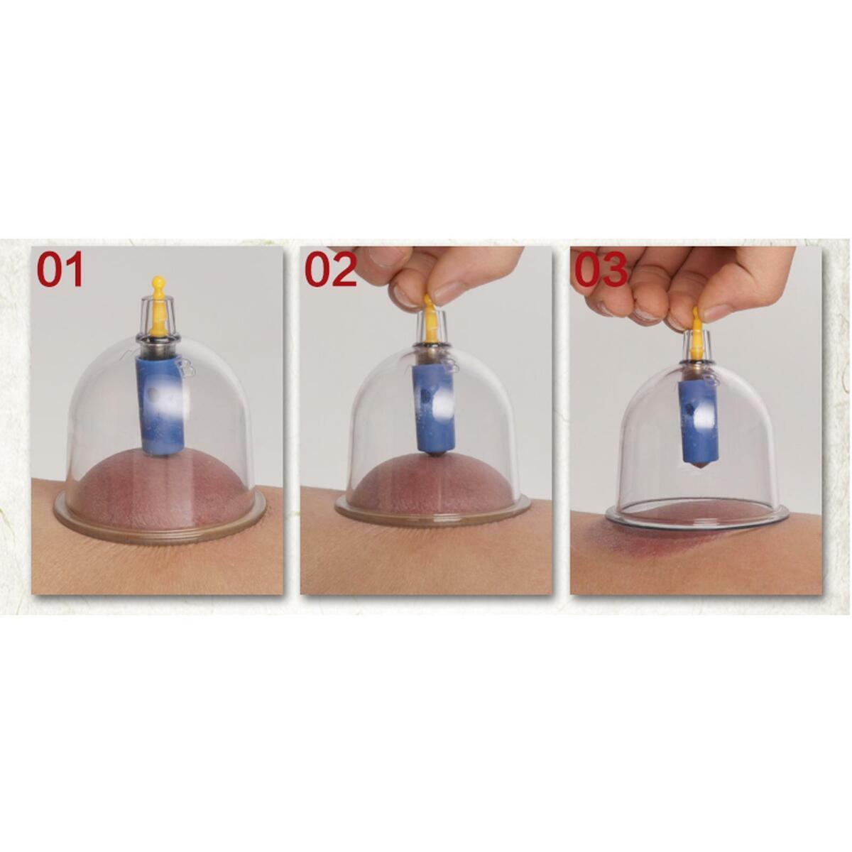 24Pcs Cups Cupping Acupuncture Massage Cup Kit Suction Pumps  Plastic