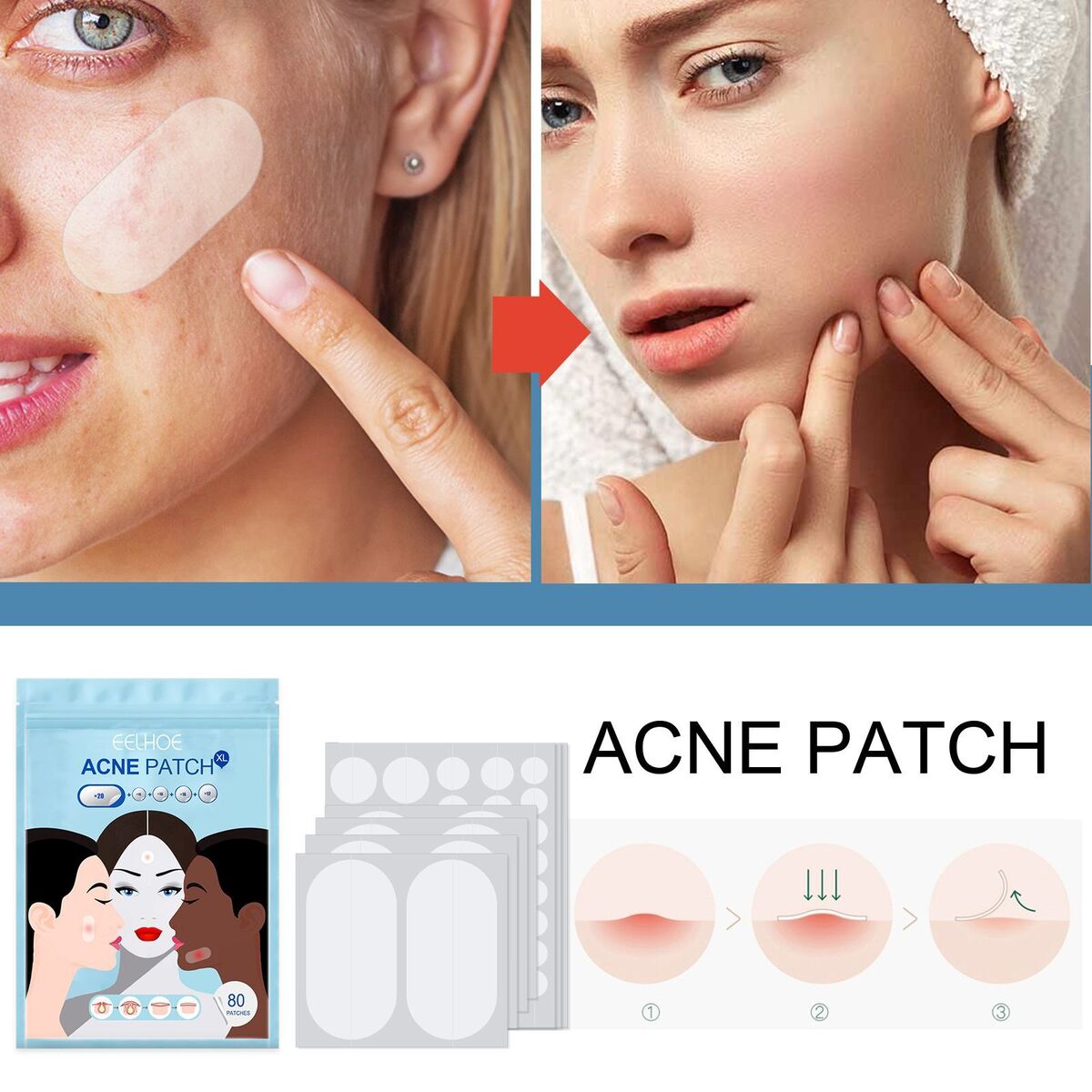 Master Acne Spot Treatment Skin Tag Remover Patch Ance Pimple Patches