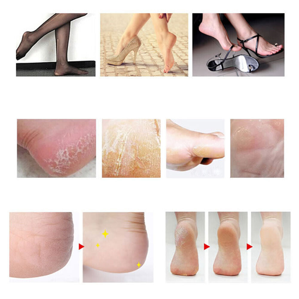 Callus Scrub Dead Skin Remover Nail Art Pedicure Tool Cuticles Buffing