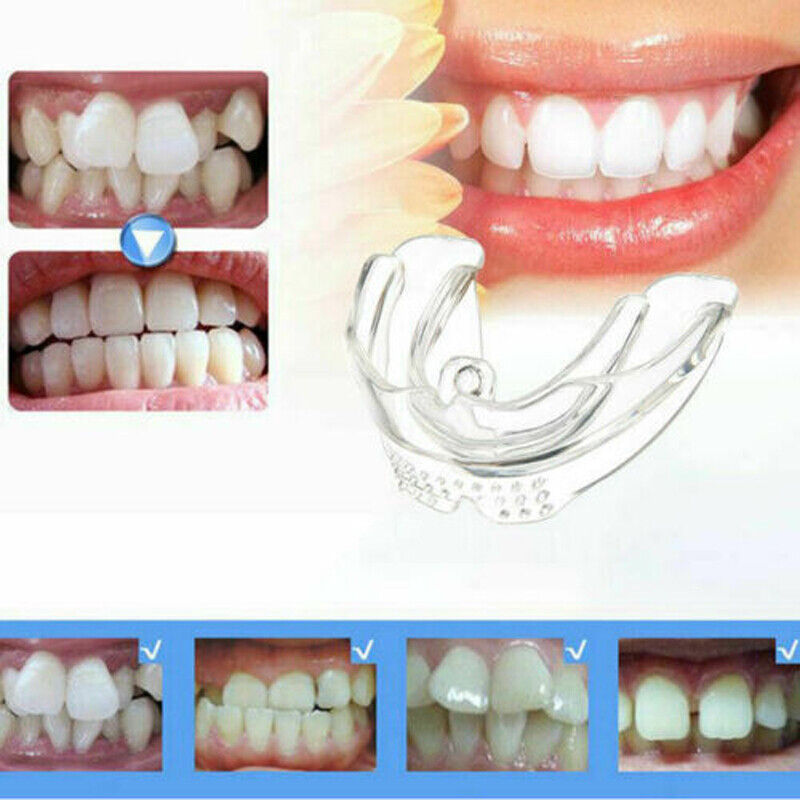 1X Dental Orthodontic Teeth Corrector Braces Tooth Retainer Straighten