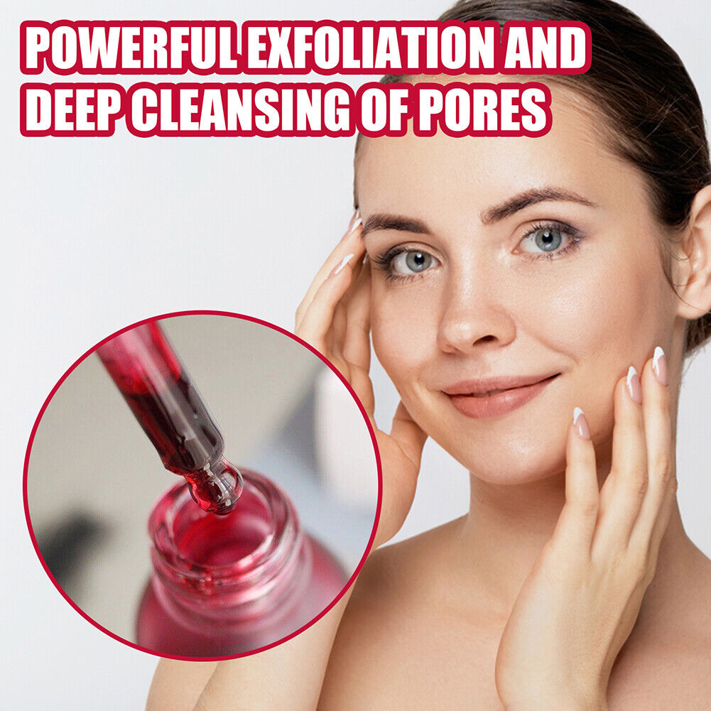 Face Peeling Serum Salicylic Acid Serum AHA30% BHA 2% Fruit Acid Extract