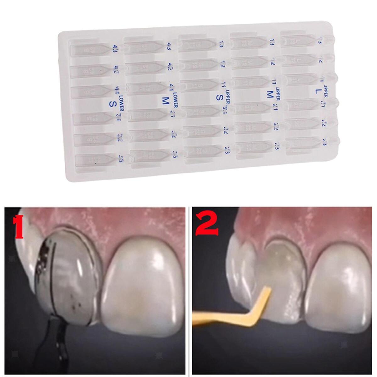 30x Dental Veneers Teeth Whitening Tool Quick Forming Autoclavable Practical
