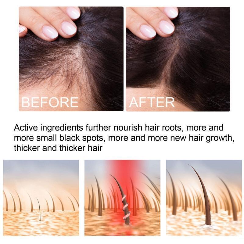 Ginger Essential Oil Stop Hair Loss Hair Thinning Treatment Hair Growth Oil 30ML