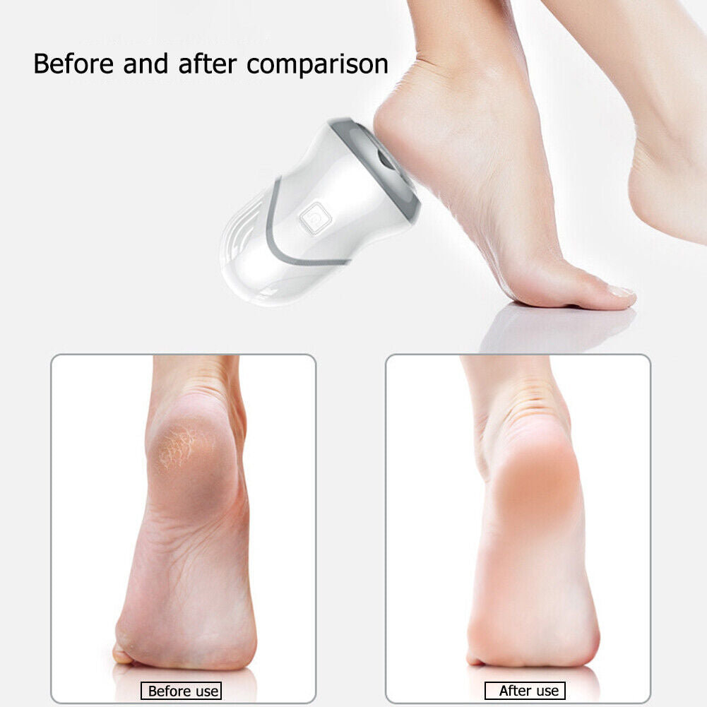 USB Rechargeable Electric Foot File Grinder Feet Dead Skin Callus Remover