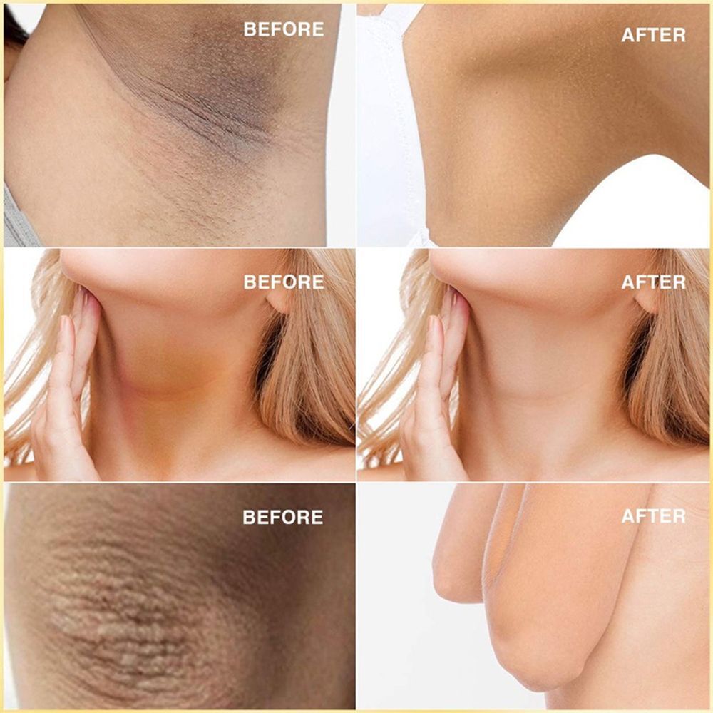 Soap Moisturizing Oil Control Cat Claw Repair Hip Care Natural Whitening Soap