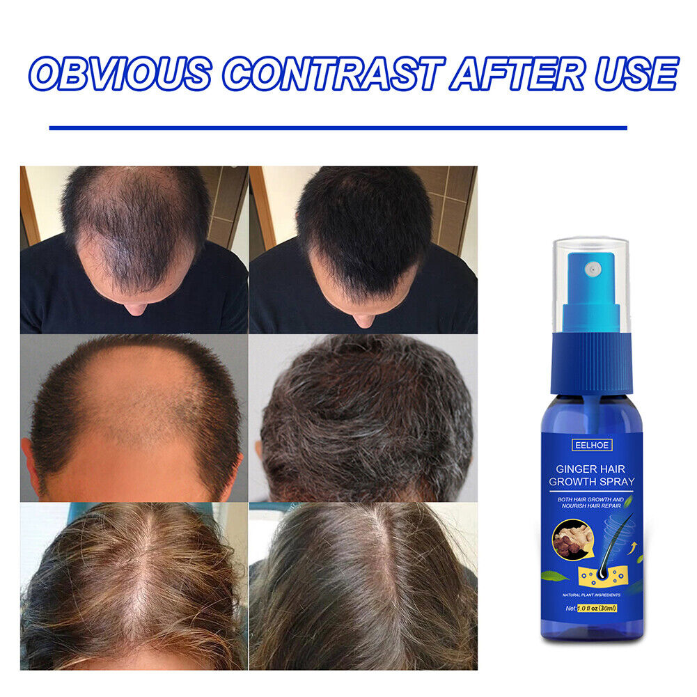 30ml Ginger Hair Spray Fast Growth Oil Plant Essence Hair Loss Treatment