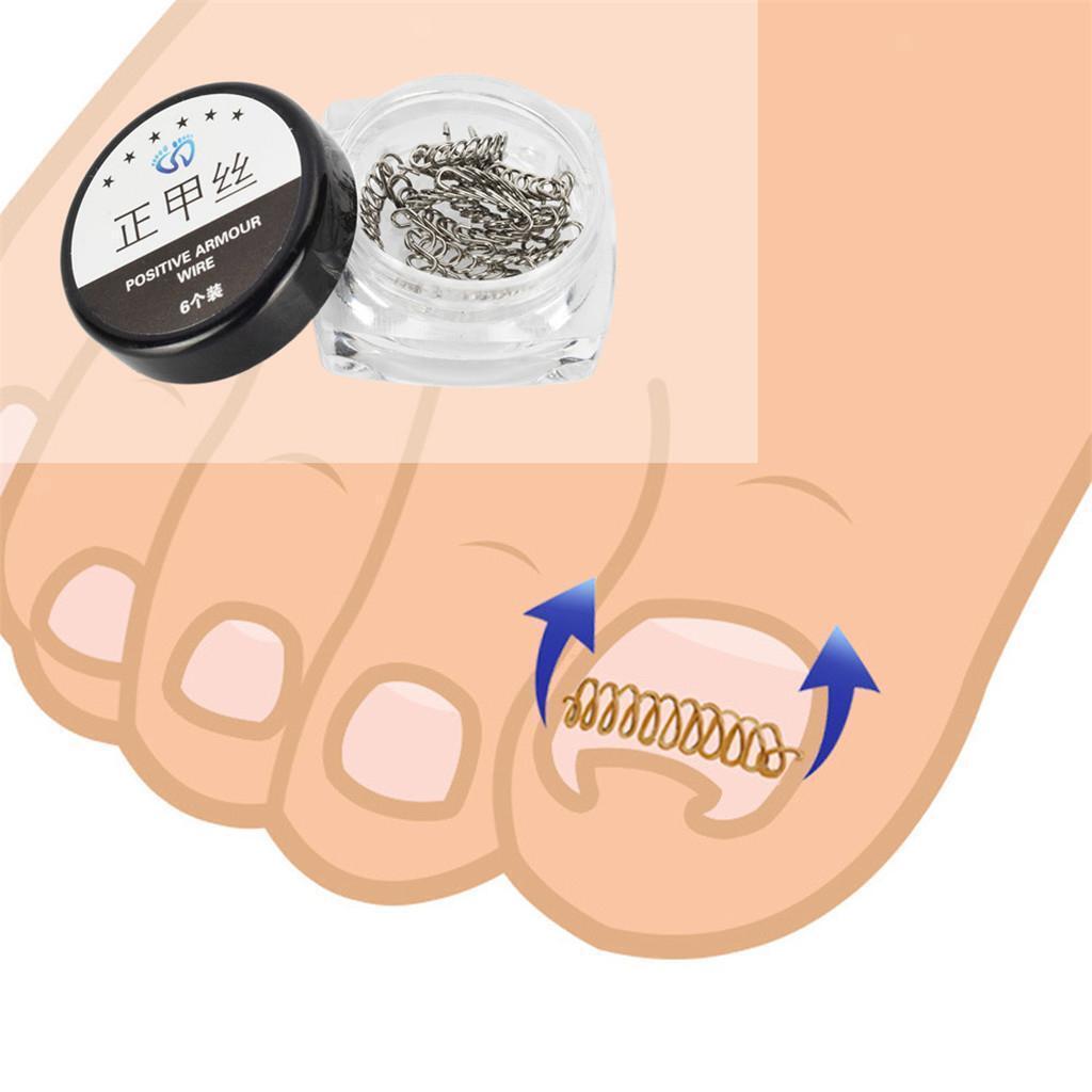 Ingrown Toe Nail Straightening Corrector Treatment with Wire Pedicure Set