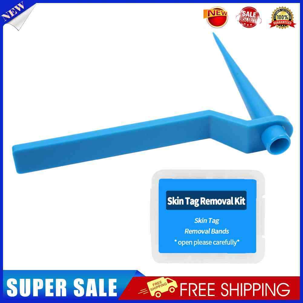 Skin Tag Remover Large Mole Wart with Removal Bands Cleansing Wipes (Blue)
