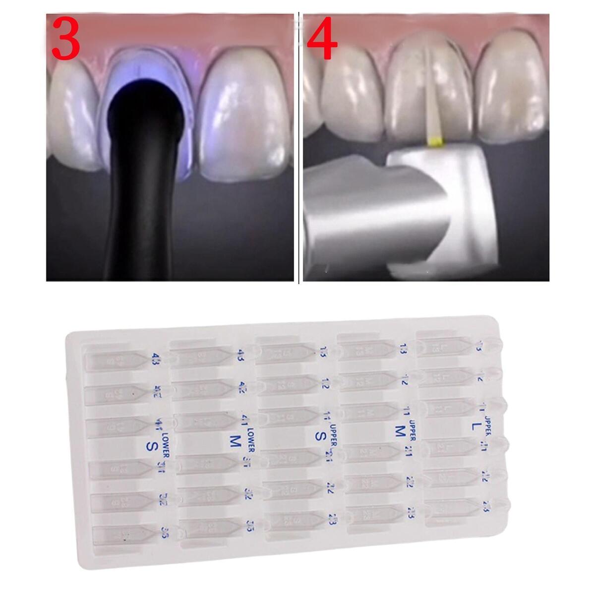 30x Dental Veneers Teeth Whitening Tool Quick Forming Autoclavable Practical