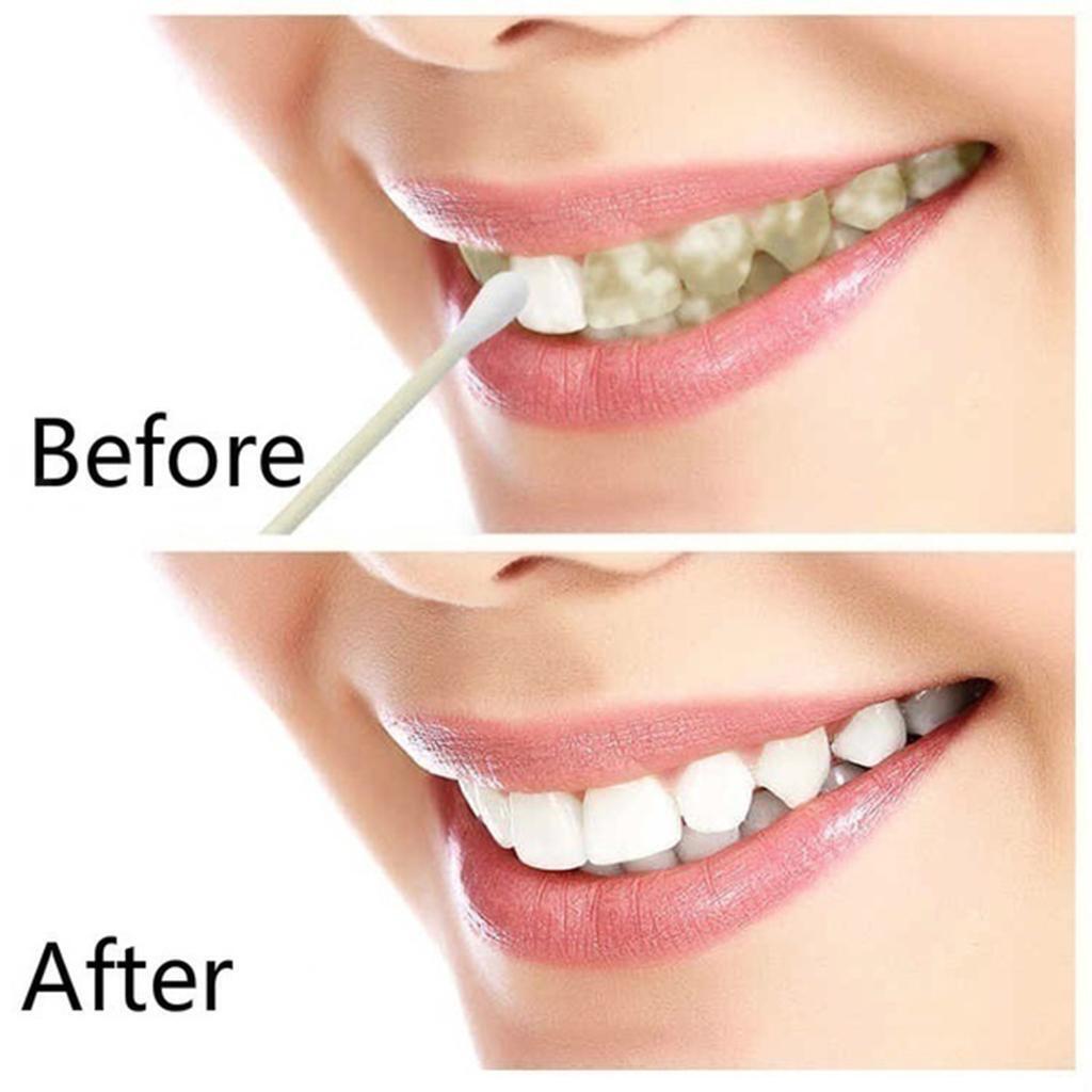 10ml Teeth Whitening Water Oral Hygiene Cleaning Teeth Care Tooth Cleaning