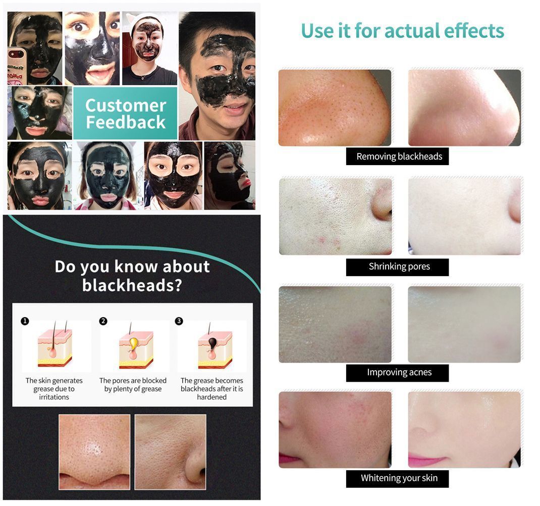 ment Skincare Face Care Bamboo Charcoal Blackhead Remover Remove black dots