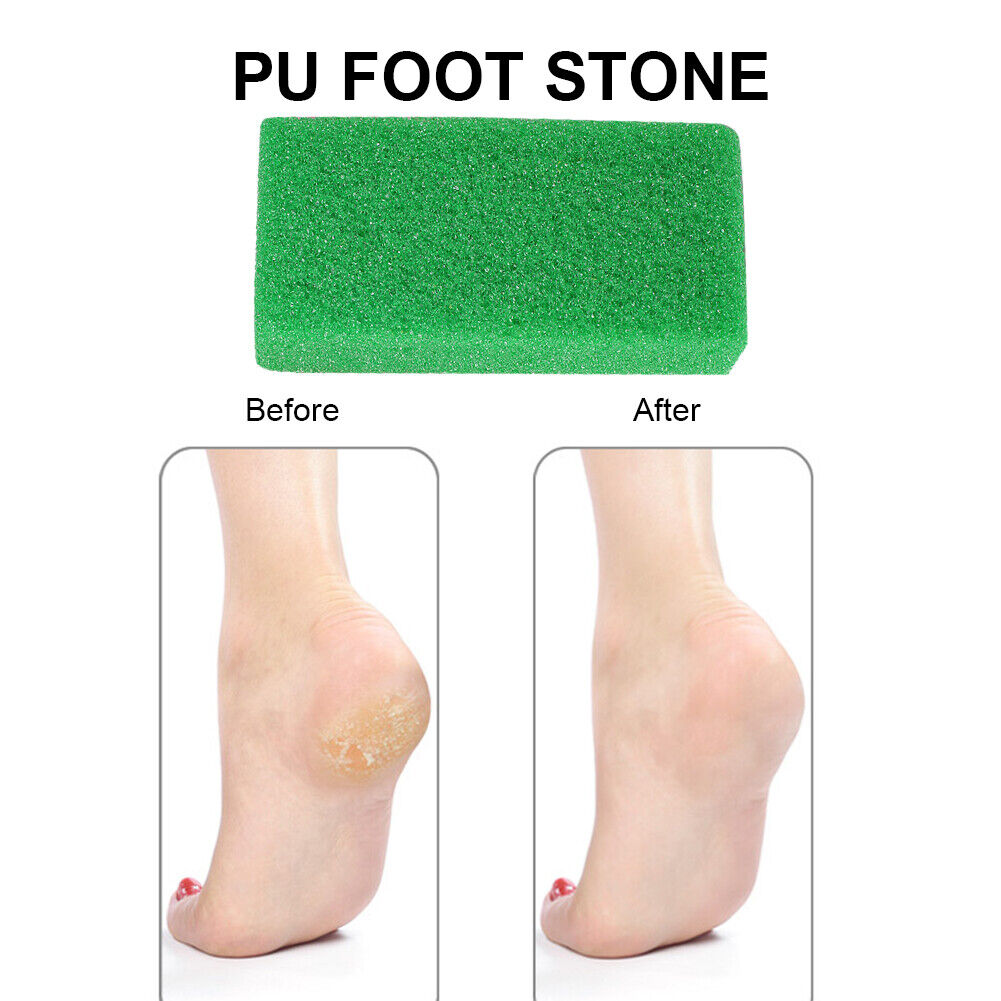 Foot Plate File Stone Dead Skin Peeling Callus Exfoliate Pedicure (Green)