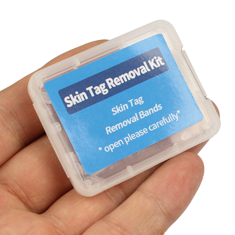 Skin Tag Removal Ring Rubber Bands Kit Acne Pimple Blemish Treatment Tools