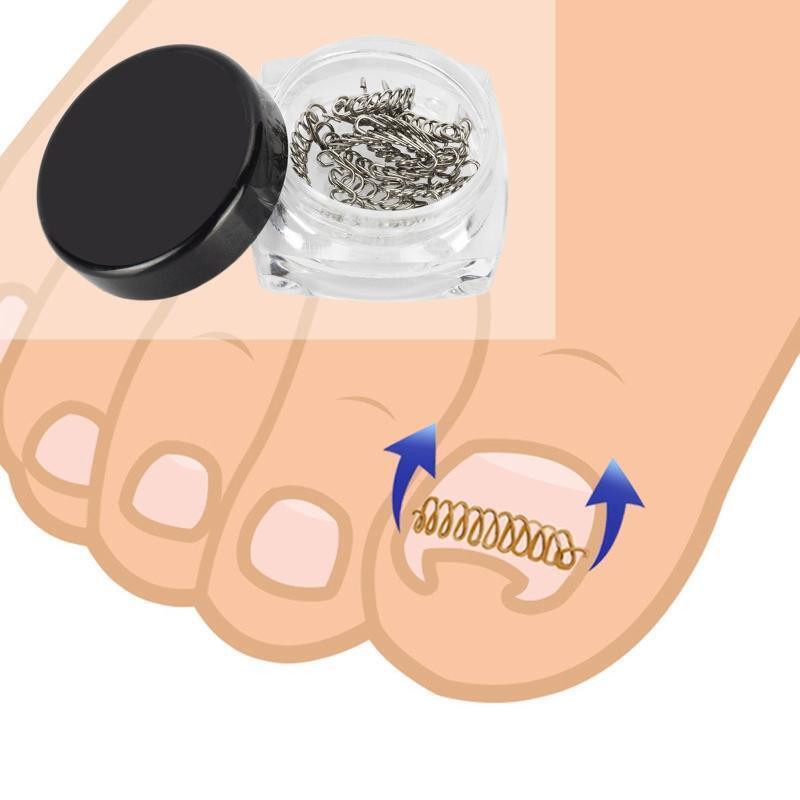 Stainless Steel Ingrown Toe Nail Wire Fixer Pedicure Recover Toenail Corrector