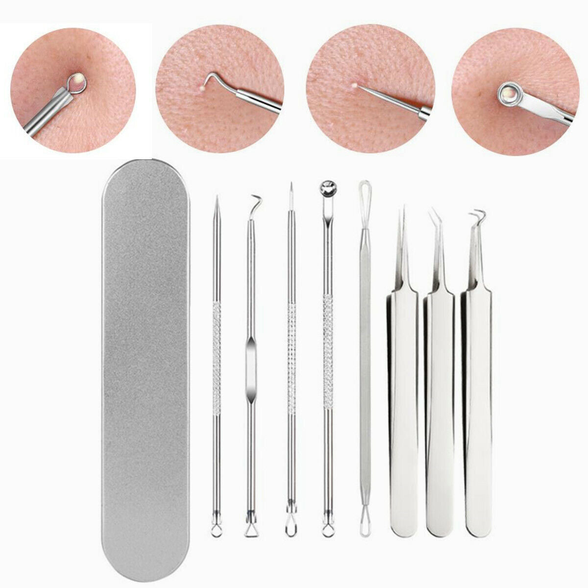 8Pcs Set Blackhead Extractor Tool Remover Pimple Blemish Comedone Kit Acne Clip