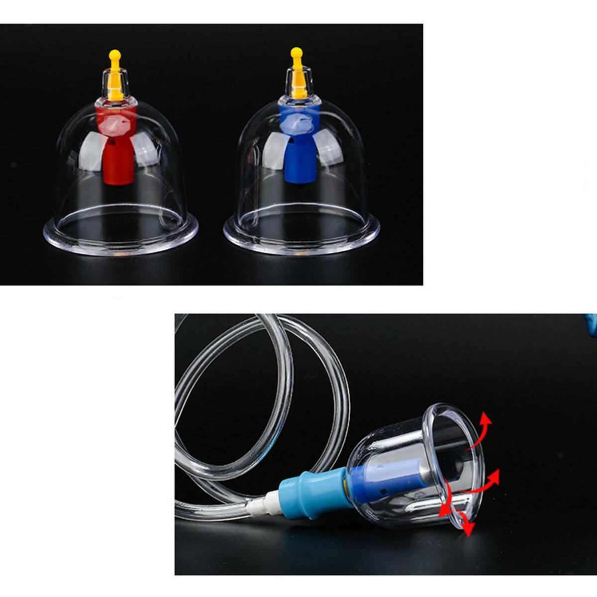 Wet/Dry Electric Cupping Kit Cupping   for Back Massage  Healthy