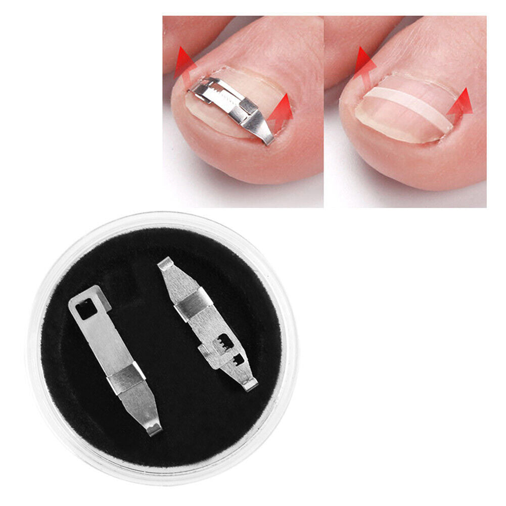 1 Pair Ingrown Toe Nail Fixer Embed Toenail Correction Lifter Pedicure Tool