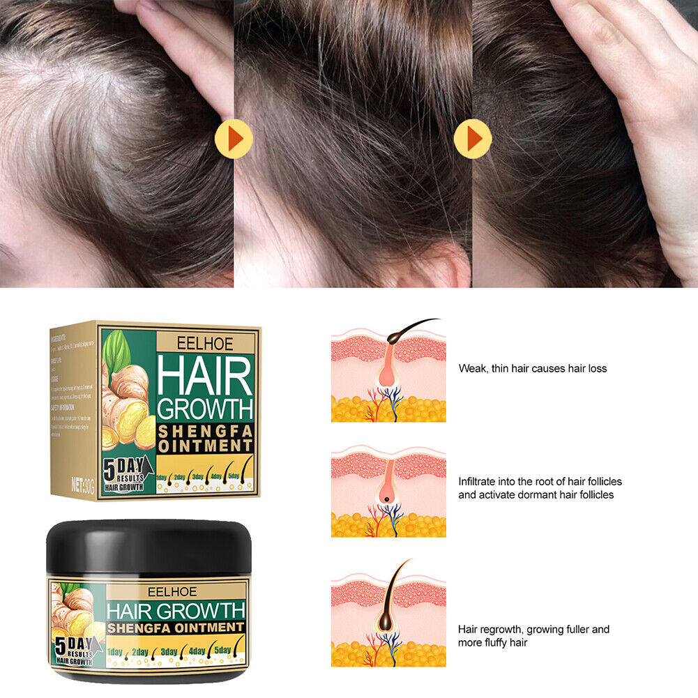 30g Ginger Hair Growth Essential Oil Serum Anti Lost Repair Scalp Treatment