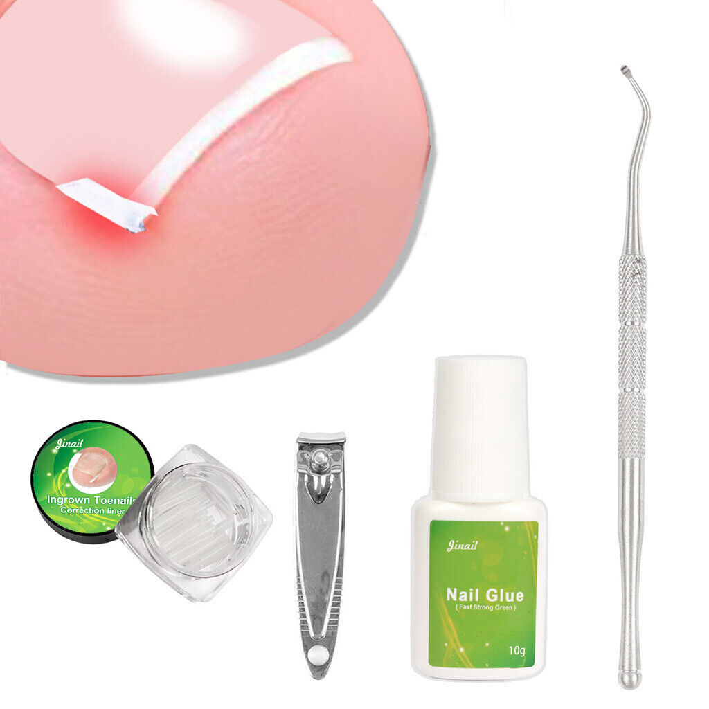 Ingrown Toenail Correction Tools Toe  Cleaner Tool 50 Liner