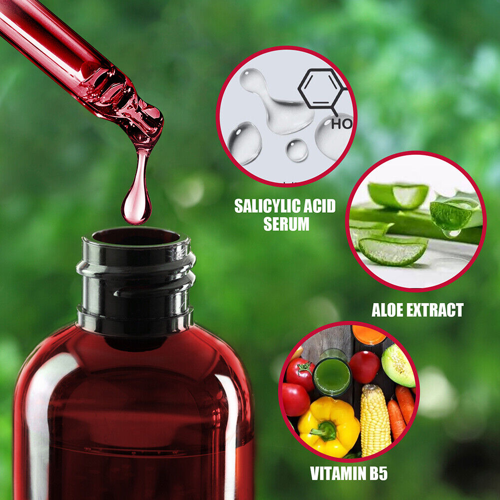 Face Peeling Serum Salicylic Acid Serum AHA30% BHA 2% Fruit Acid Extract