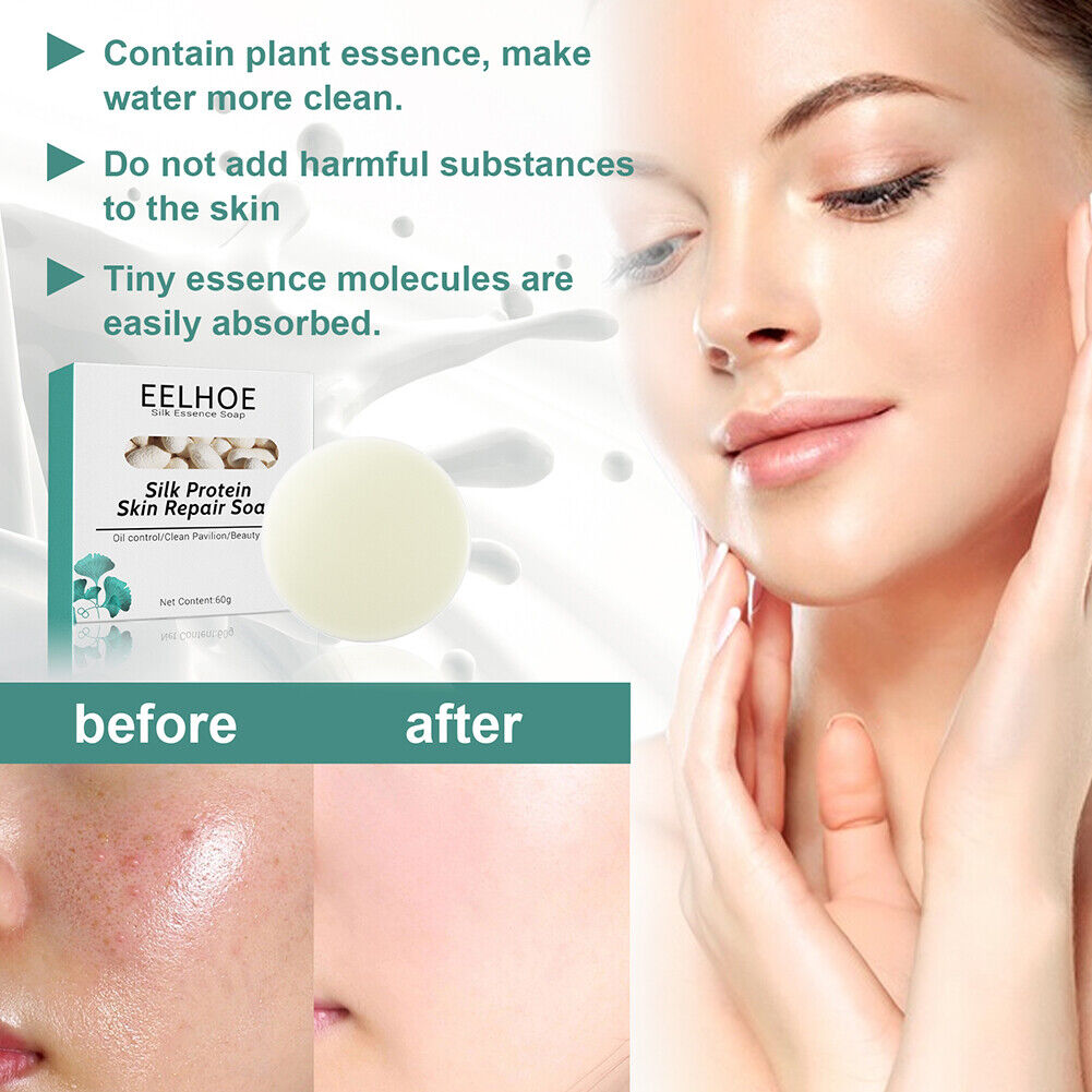 Silk Protein Soap Oil Control Face Deep Cleansing Pores Mites Acne Remover