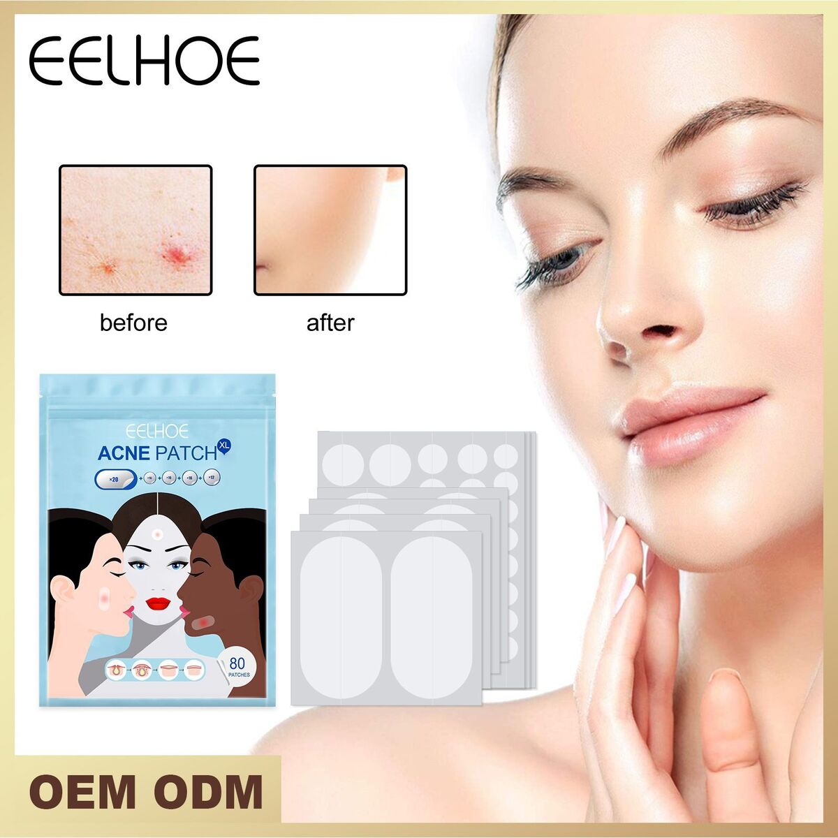 Pimple Patches Hydrocolloid Master Acne Spot Treatment Skin Tag Remover Patch