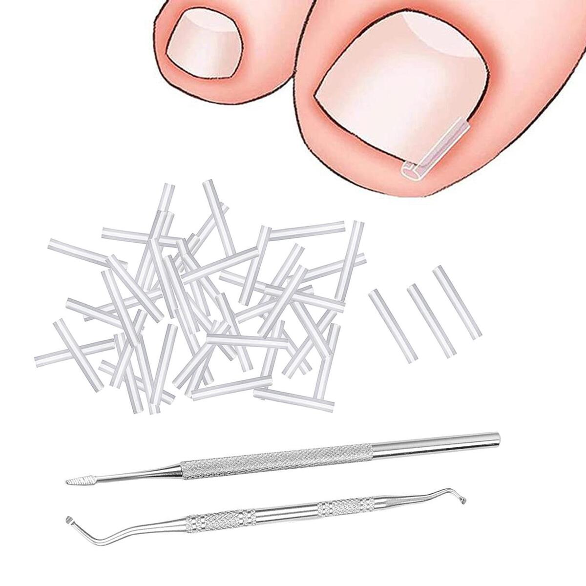 50Pcs Ingrown Toenail Corrector Strips Thick Paronychia Pedicure Tool Brace Nail