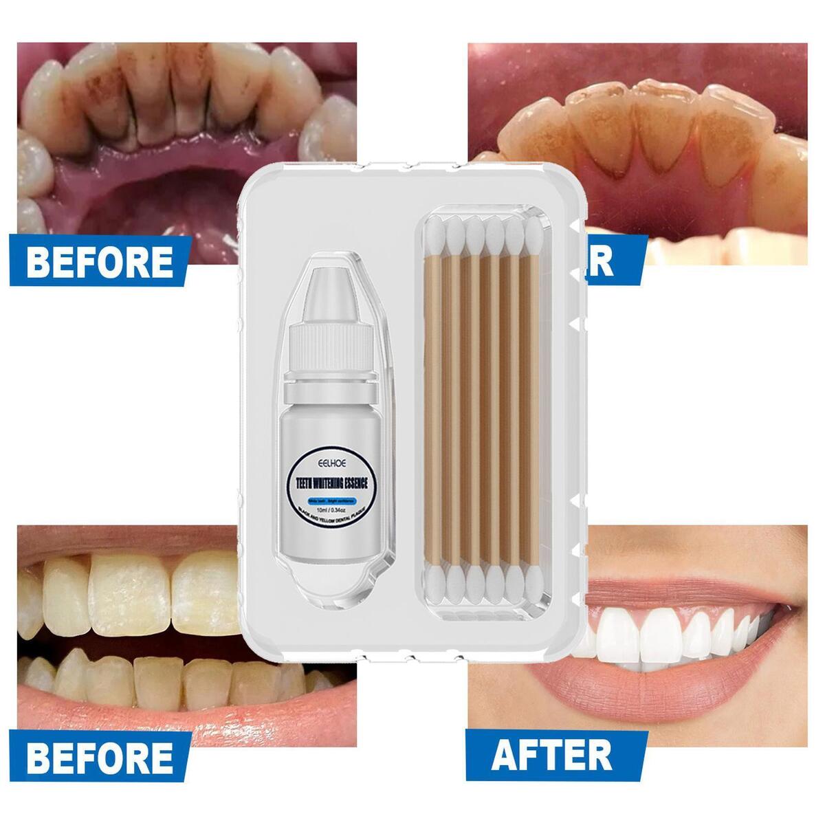 Teeth Whitening Essence Tea Stains Sensitive Teeth Stains Removes Travel