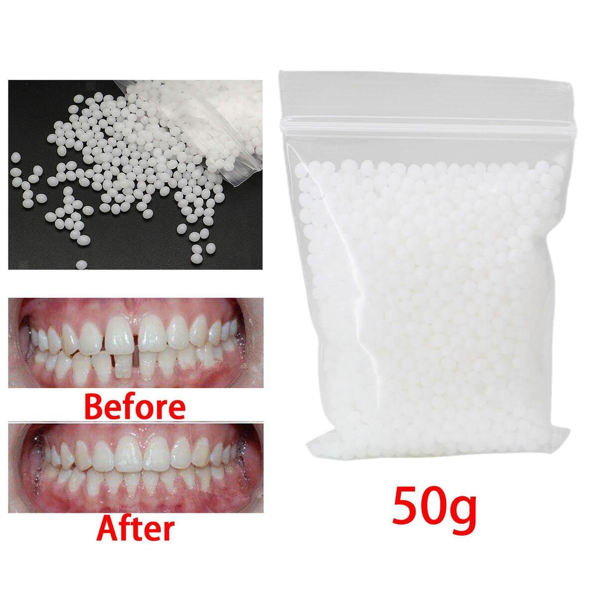 50G Temporary  Repair Kit False  Moldable  Veneers White