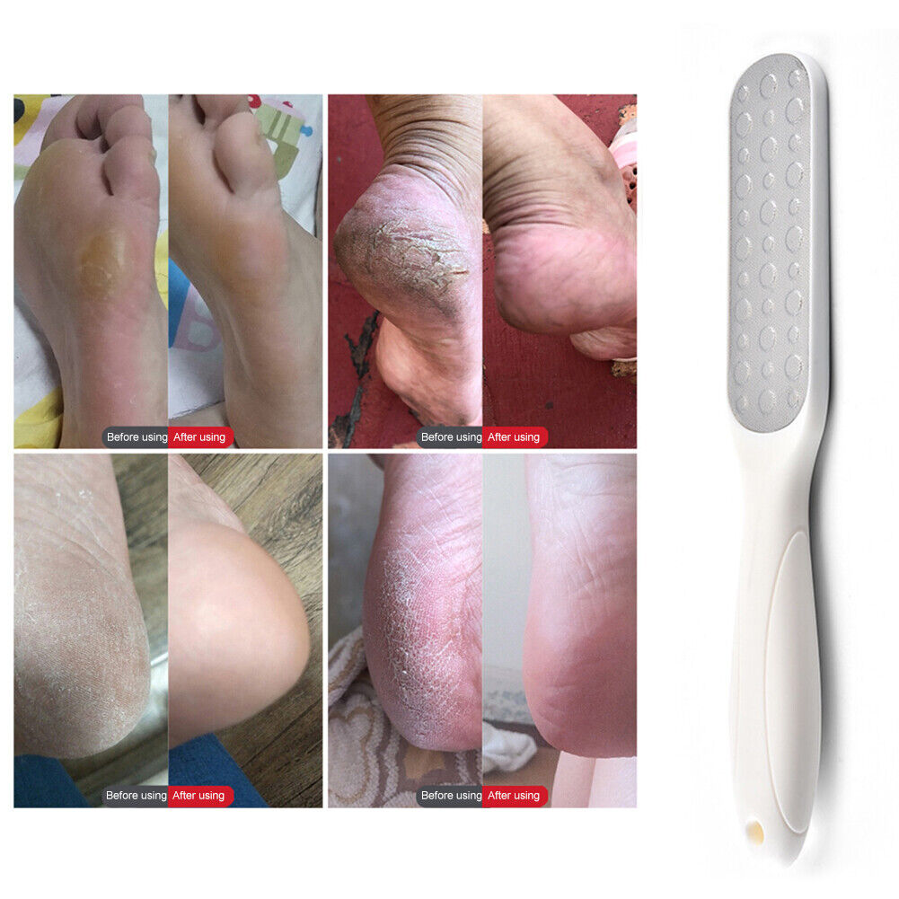 Foot Grinder Foot Rasp Dry Rough Dead Skin Callus Remover Large Foot File