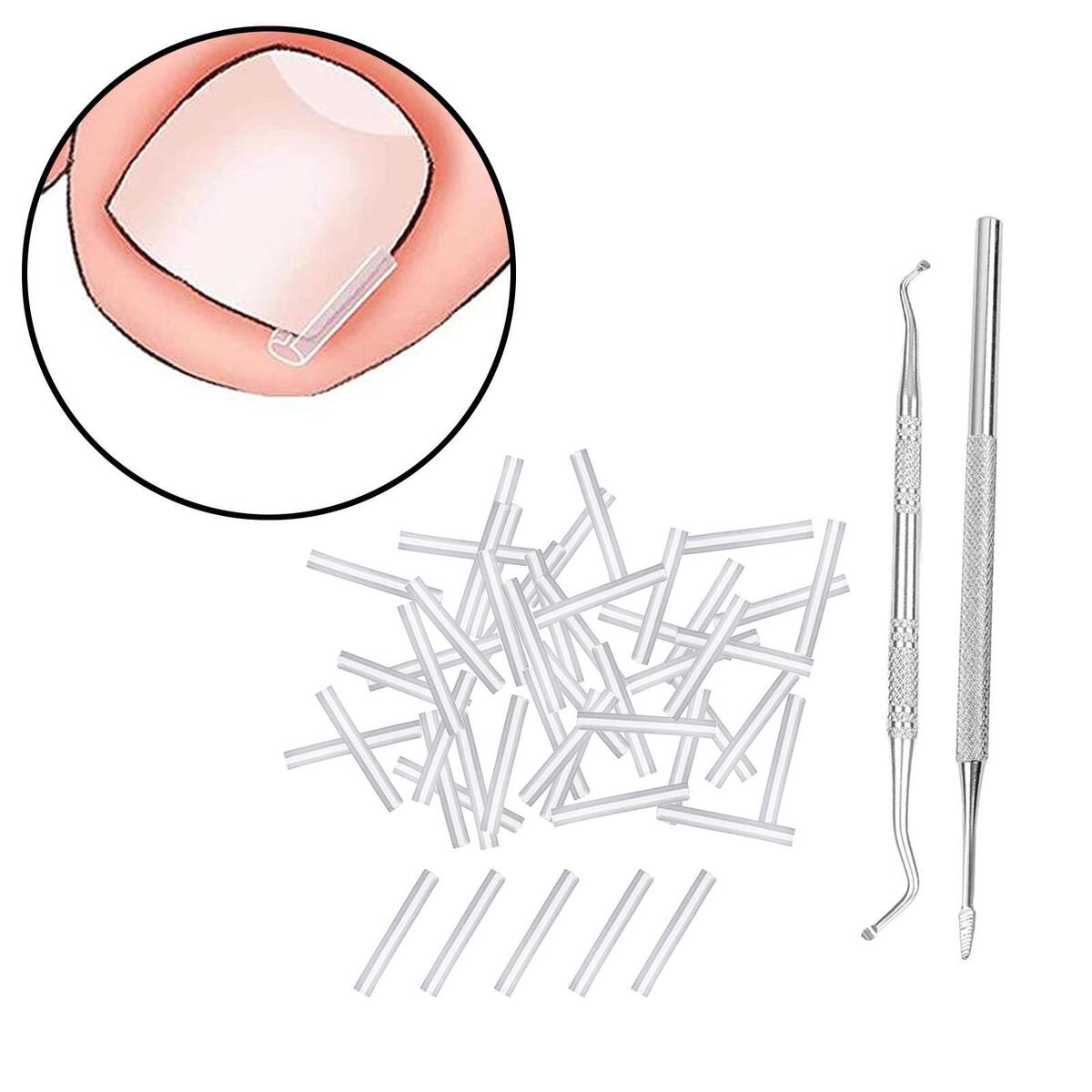 50Pcs Ingrown Toenail Corrector Strips Thick Paronychia Pedicure Tool Brace Nail