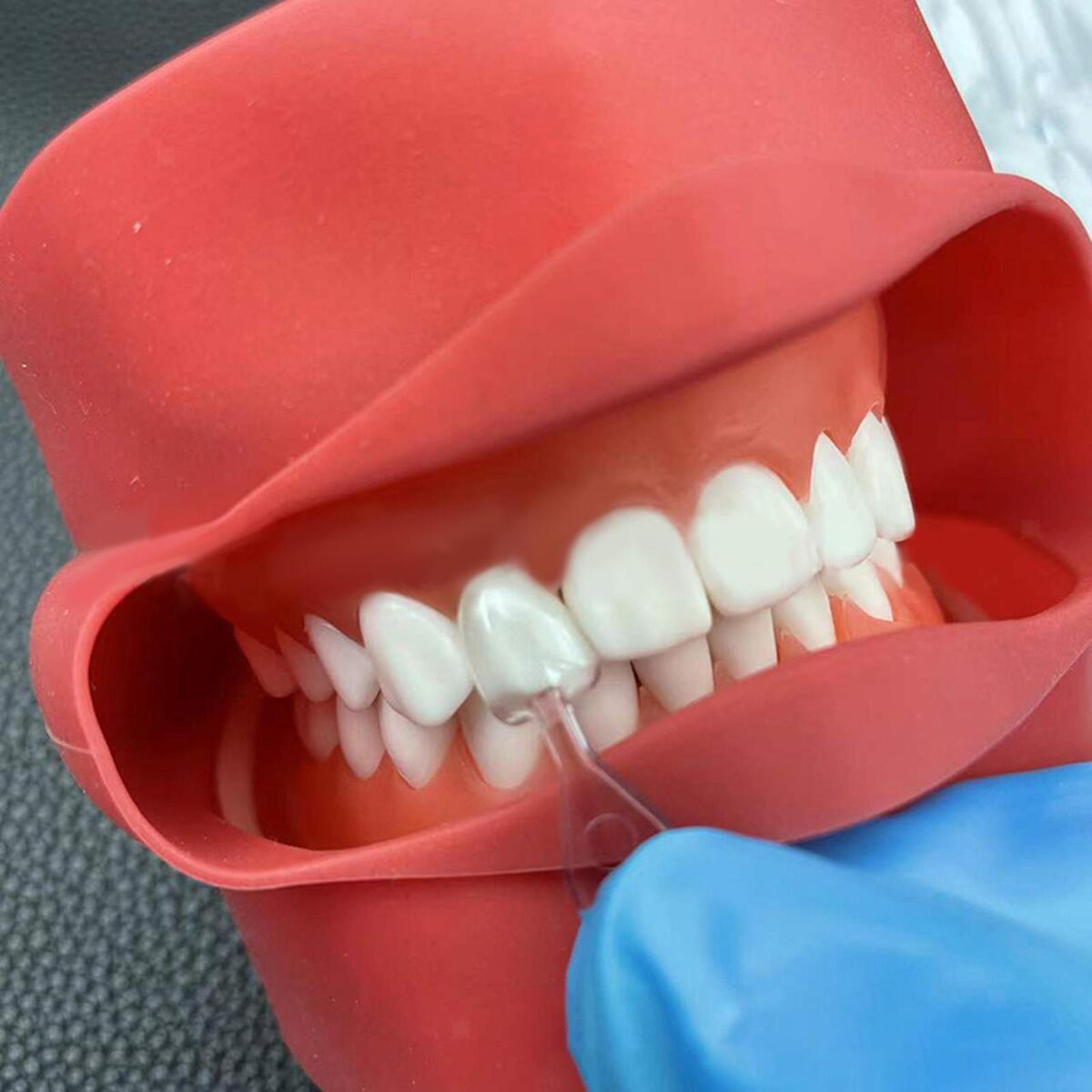 30x Dental Veneers Teeth Whitening Tool Quick Forming Autoclavable Practical