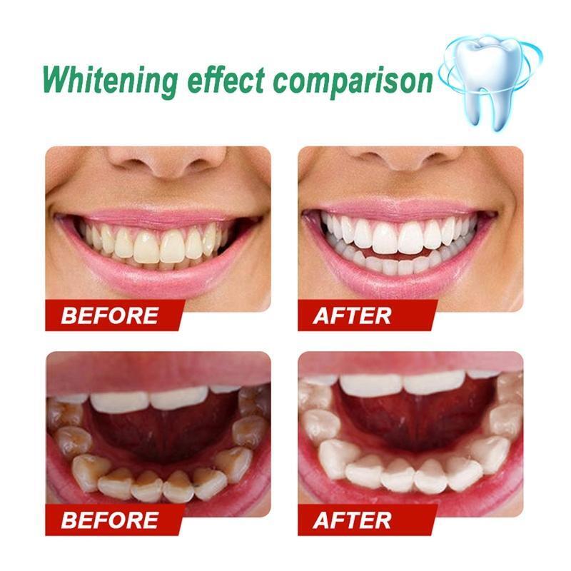 50ml Teeth Whitening Powder Tooth Powder Products Beauty Health Remove Stain