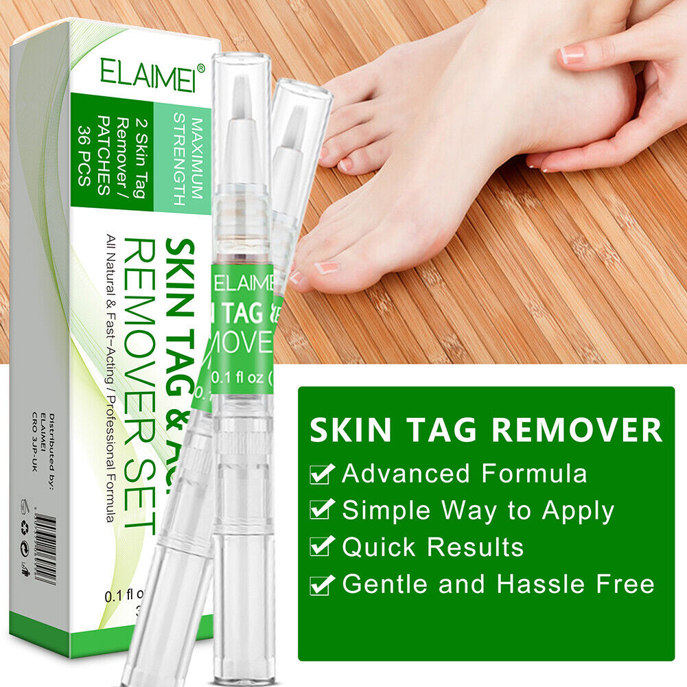 Portable Skin Tag Remover Pen Patch Wart Remove Acne Mole Treatment Tool