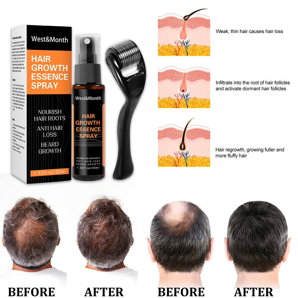 Effective Beard Growth Essence Spray Nourishing Enhancer Oil (Spray Roller)