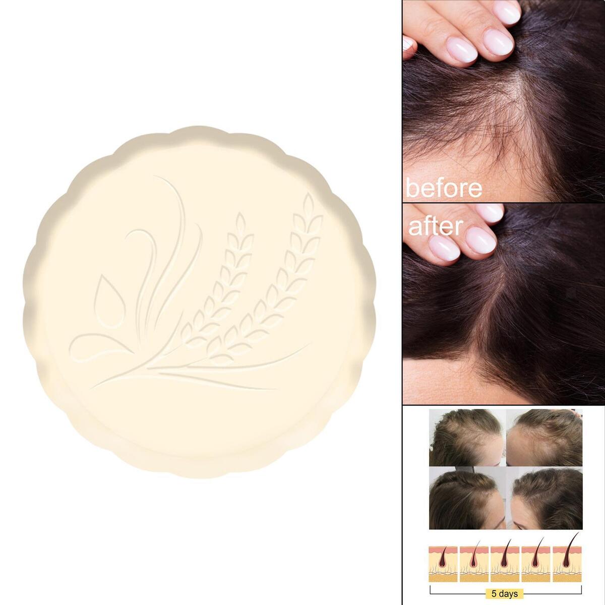 Rice Shampoo Soap, Nourishhair, Solid Shampoo Soap, for Stop Hair Loss Dry