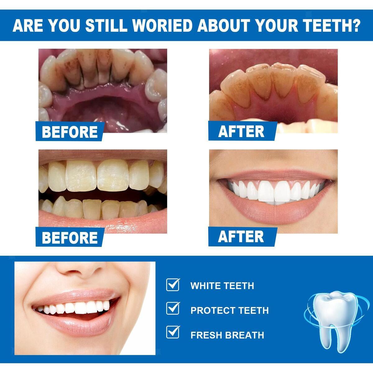 Teeth Whitening Essence Tea Stains Sensitive Teeth Stains Removes Travel
