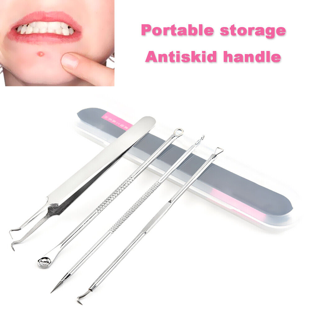 4pcs Black Dot Pimple Blackhead Remover Tool Needle Set Squeezing Acne Tool