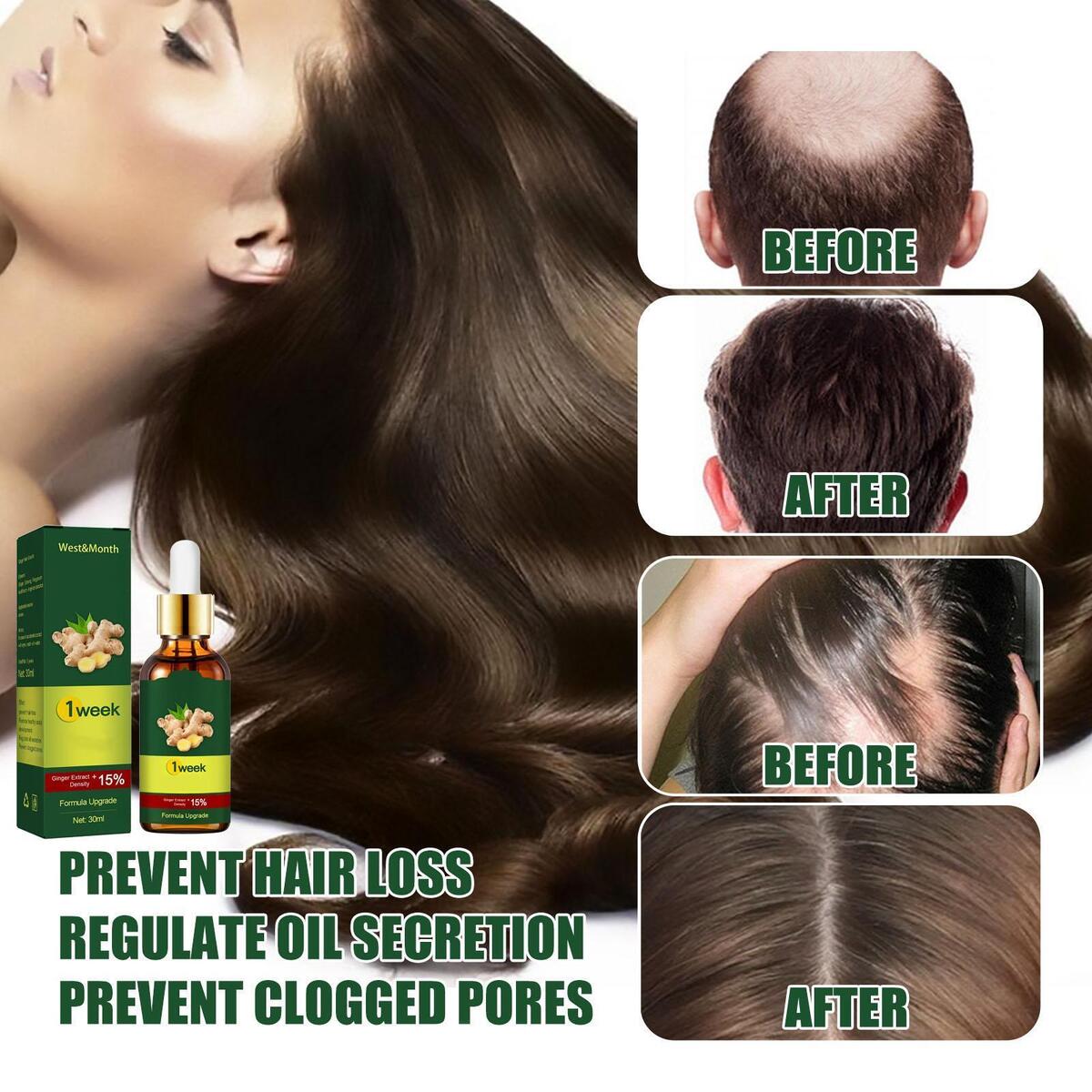 30ml Ginger Hair Growth Serum, Stop Hair Loss Repair Damaged Hair for Dry and