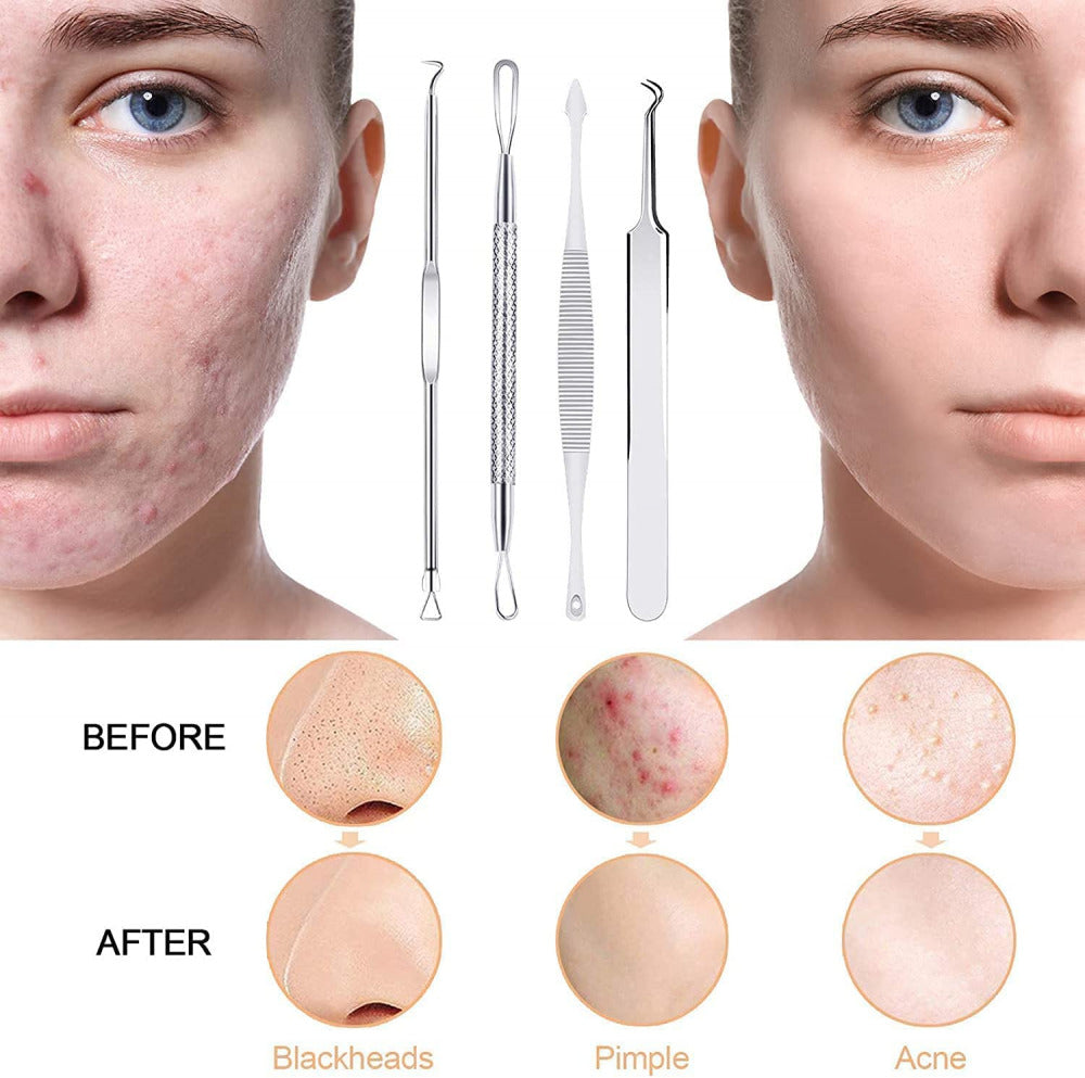 Stainles Steel Blackheads Acne Acne Face Extractor Skin Care Acne Tool 10pcs